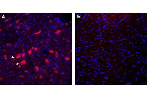 Expression of CD157 in rat deep cerebellar nuclei. (BST1 Antikörper  (Extracellular))