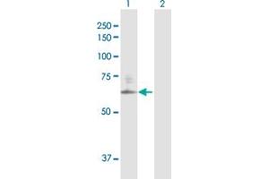 Western Blot analysis of GALNACT-2 expression in transfected 293T cell line by GALNACT-2 MaxPab polyclonal antibody. (CSGALNACT2 Antikörper  (AA 1-542))