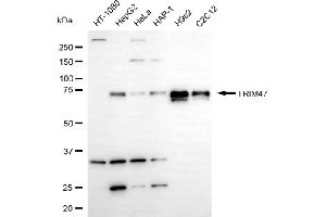 Western blotting analysis using TRIM47 antibody (ABIN7800635). (TRIM47 Antikörper)
