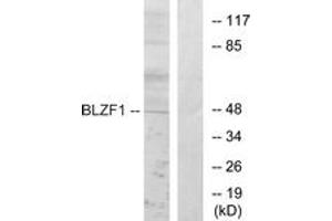 Western blot analysis of extracts from Jurkat cells, using BLZF1 Antibody. (BLZF1 Antikörper  (AA 10-59))
