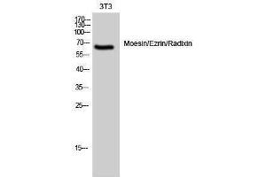 Western Blotting (WB) image for anti-Moesin/ezrin/radixin (Ser105) antibody (ABIN3185614) (Moesin/ezrin/radixin (Ser105) Antikörper)