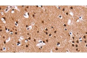 Immunohistochemistry of paraffin-embedded Human brain using RPSA Polyclonal Antibody at dilution of 1:60 (RPSA/Laminin Receptor Antikörper)
