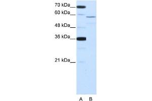 WB Suggested Anti-NOVA2 Antibody Titration:  2. (NOVA2 Antikörper  (Middle Region))