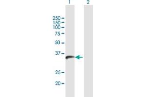 Western Blot analysis of PPIL6 expression in transfected 293T cell line by PPIL6 MaxPab polyclonal antibody. (PPIL6 Antikörper  (AA 1-311))
