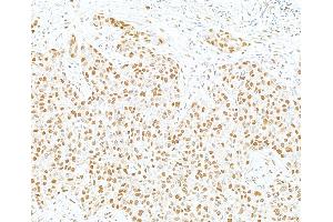 Immunohistochemistry (IHC) image for anti-SWI/SNF Related, Matrix Associated, Actin Dependent Regulator of Chromatin, Subfamily E, Member 1 (SMARCE1) (C-Term) antibody (ABIN7795730)