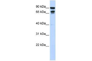 WB Suggested Anti-MSL3L1 Antibody Titration:  0. (MSL3 Antikörper  (N-Term))