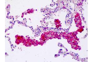 Anti-CORO6 antibody IHC staining of human lung, macrophages. (Coronin 6 Antikörper  (AA 337-365))