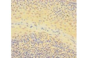 Immunohistochemistry of paraffin-embedded human tonsil tissue using ABIN7150361 at dilution of 1:100 (IKZF1 Antikörper  (AA 1-265))