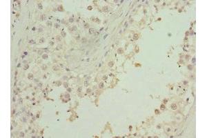 Immunohistochemistry of paraffin-embedded human testis tissue using ABIN7176258 at dilution of 1:100 (ZNF35 Antikörper  (AA 233-532))
