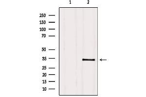 Western blot analysis of extracts from HepG2, using PMM2 Antibody. (PMM2 Antikörper  (C-Term))