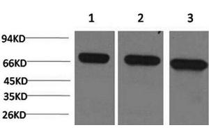 Western Blot analysis of 1) Hela, 2)Mouse brain, 3) Rat brain using HSPA8 Monoclonal Antibody at dilution of 1:2000. (Hsc70 Antikörper)