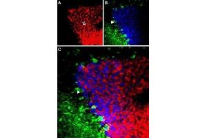 Immunohistochemistry (IHC) image for anti-gamma-aminobutyric Acid (GABA) A Receptor, alpha 6 (GABRA6) (AA 20-37), (Extracellular) antibody (ABIN7043190)