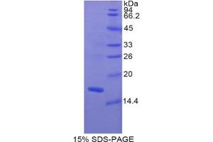 SDS-PAGE (SDS) image for Myosin, Light Chain 1, Alkali, Skeletal, Fast (MYL1) protein (ABIN3010824)