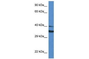 Western Blot showing NQO1 antibody used at a concentration of 1 ug/ml against HT1080 Cell Lysate (NQO1 Antikörper  (Middle Region))