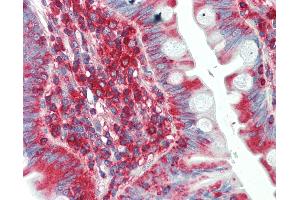 Anti-SCN1B antibody IHC staining of human small intestine. (SCN1B Antikörper  (AA 110-159))