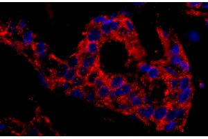 Immunohistochemistry (IHC) image for anti-Sorting Nexin 1 (SNX1) (C-Term) antibody (ABIN7449439)