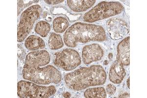 ABIN6266490 at 1/100 staining human kidney tissue sections by IHC-P. (GAB2 Antikörper  (C-Term))