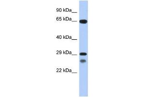 WB Suggested Anti-MYF5 Antibody Titration: 0. (MYF5 Antikörper  (C-Term))