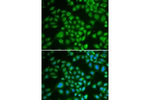 Immunofluorescence analysis of HeLa cells using DCK antibody (ABIN3022557, ABIN3022558, ABIN3022559 and ABIN6218902). (DCK Antikörper  (AA 1-260))