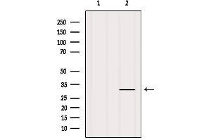 Western blot analysis of extracts from Mouse brain, using CD11c Antibody.