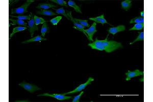 Immunofluorescence of monoclonal antibody to CALM3 on HeLa cell. (Calmodulin 3 Antikörper  (AA 53-149))