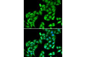 Immunofluorescence analysis of U2OS cells using COPS3 antibody (ABIN5974222). (COPS3 Antikörper)