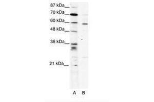 Image no. 1 for anti-PDZ and LIM Domain 5 (PDLIM5) (AA 165-214) antibody (ABIN202009) (PDLIM5 Antikörper  (AA 165-214))