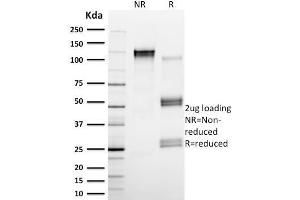 SDS-PAGE Analysis Purified Calpain 1 Mouse Monoclonal Antibody (CAPN1/1530). (CAPNL1 Antikörper)