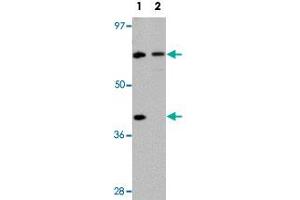 Western blot analysis of TCTN3 in HeLa cell lysate with TCTN3 polyclonal antibody  at (1) 1 and (2) 2ug/mL. (TCTN3 Antikörper  (C-Term))