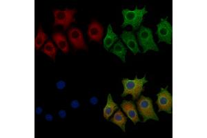ABIN6257712 and ABIN6273523 staining HepG2 cells by IF/ICC.