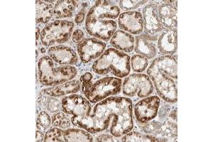 Immunohistochemical staining of human kidney with SLFN12L polyclonal antibody  shows strong cytoplasmic positivity in tubular cells at 1:20-1:50 dilution. (SLFN12L Antikörper)