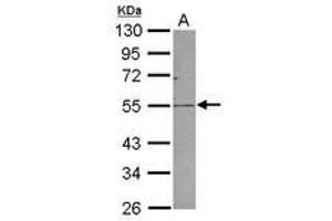 Image no. 1 for anti-Plasmalemma Vesicle Associated Protein (PLVAP) (AA 203-442) antibody (ABIN1500292) (PLVAP Antikörper  (AA 203-442))