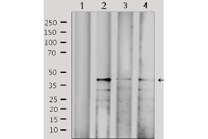 Western blot analysis of extracts from various samples, using CBX6 Antibody. (CBX6 Antikörper  (N-Term))