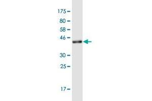 Western Blot detection against Immunogen (36. (CAGE1 Antikörper  (AA 2-100))