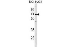 Western Blotting (WB) image for anti-Potassium Intermediate/small Conductance Calcium-Activated Channel, Subfamily N, Member 1 (KCNN1) antibody (ABIN2999295) (KCNN1 Antikörper)
