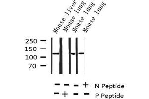 Western blot analysis of Phospho-HDAC5 (Ser498) expression in various lysates