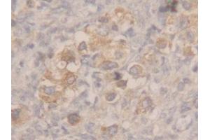 Used in DAB staining on fromalin fixed paraffin-embedded stomach tissue (MSMB Antikörper  (AA 19-114))