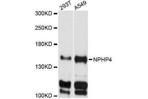 Western blot analysis of extracts of various cell lines, using NPHP4 antibody (ABIN5996805) at 1:3000 dilution. (NPHP4 Antikörper)