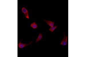 ABIN6261581 and ABIN6272294 staining HepG2 by IF/ICC. (EPS8-Like 3 Antikörper  (Internal Region))