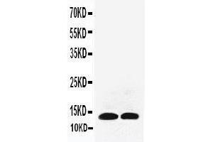 Anti-IL13 antibody, Western blotting All lanes: Anti IL13  at 0.