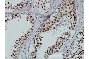 Image no. 1 for anti-RNA Binding Motif Protein, X-Linked-Like 2 (RBMXL2) (AA 1-91) antibody (ABIN599219) (RBMXL2 Antikörper  (AA 1-91))