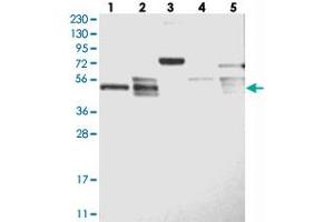 Western blot analysis of Lane 1: RT-4, Lane 2: U-251 MG, Lane 3: Human Plasma, Lane 4: Liver, Lane 5: Tonsil with LACE1 polyclonal antibody .