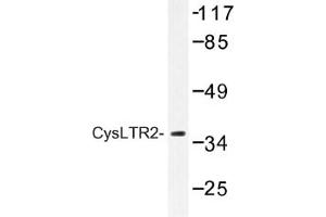 Image no. 1 for anti-Cysteinyl Leukotriene Receptor 2 (CYSLTR2) antibody (ABIN317646) (CasLTR2 Antikörper)