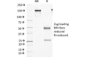 SDS-PAGE Analysis Purified Protocadherin FAT2 Monoclonal Antibody (8C5).