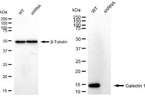 Western blotting analysis using Galectin 1 antibody (ABIN7799242).