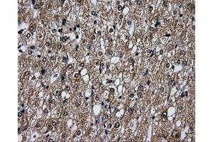 Immunohistochemical staining of paraffin-embedded liver tissue using anti-PLEKmouse monoclonal antibody. (Pleckstrin Antikörper)