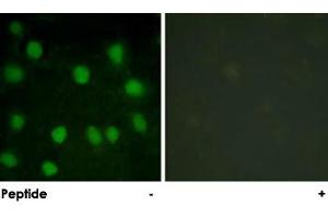Immunofluorescence analysis of HUVEC cells, treated with serum (20 %, 30 mins), using EPB49 polyclonal antibody . (Dematin Antikörper)
