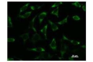 Immunostaining analysis in HeLa cells. (DDX3X Antikörper)