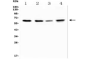 Western blot analysis of TRAF6 using anti-TRAF6 antibody (ABIN7600026).