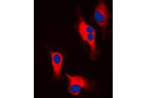 Immunofluorescent analysis of Tyrosine Hydroxylase staining in A549 cells. (Tyrosine Hydroxylase Antikörper  (N-Term))